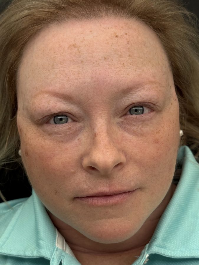 Résultat nano brows